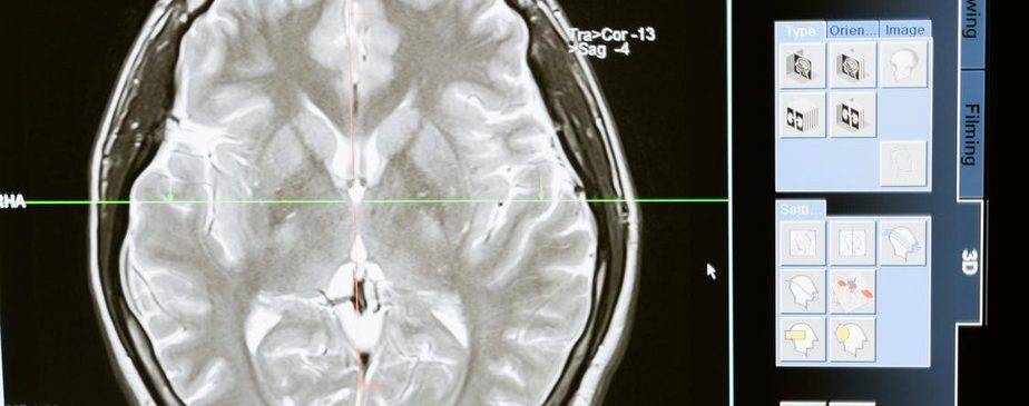 The Importance of Using a Brain Injury Attorney After a TBI