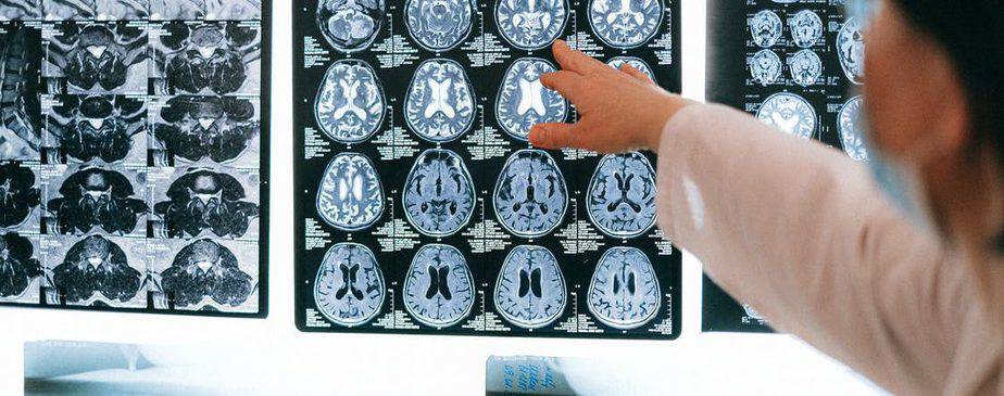 What is Anoxic Brain Injury