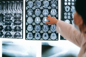 What is Anoxic Brain Injury