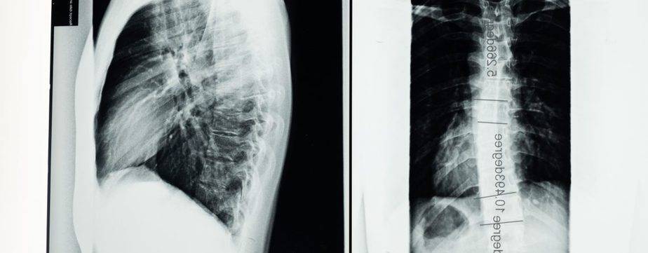 What is Florida's Brain and Spinal Cord Injury Program